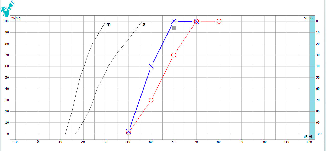 Graphique Audio Vocale